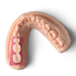 Phrozen-Harz-Zahnfleischmaske (0,5 kg)